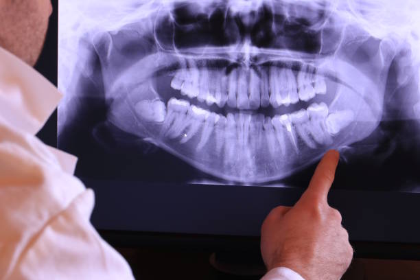 Best Emergency Dental Services for Seniors in Mooresville, NC