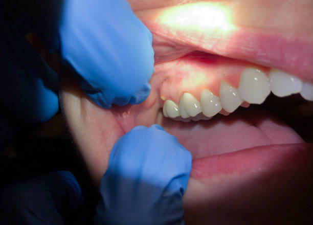 Best Orthodontic Emergency Dentist in Mooresville, NC