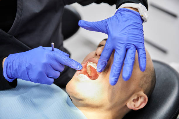 Best Emergency Dentist for Lost Fillings or Crowns in Mooresville, NC